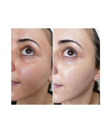 Kanza Skin Whitening Soap - Buy Online on GoSupps.com