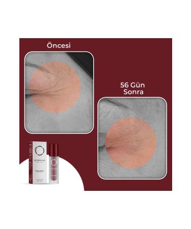 MORPHIYA Concentrate Anti-Aging Skin Renewal and Moisturizing Cream 30 ml - Buy Online on GoSupps.com