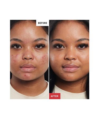 erborian Baby Skin Smoothing Care SPF20 - BB Cream-Chocolat-40 ml - Buy Online on GoSupps.com