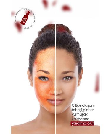 EVOL Soft Moisturizer Intensive Moisturizing Skin Care Cream for Sensitive Skin Types 150 ml - Buy Online on GoSupps.com