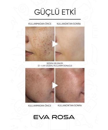 Eva Rosa Aha & Bha Revitalizing & Skin Tone Equalizing Red Peeling Skin Serum 30 ml - Buy Online on GoSupps.com