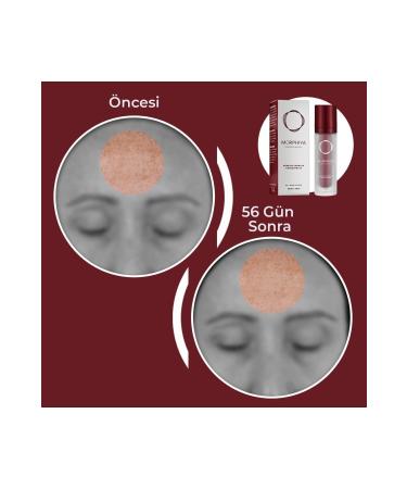 MORPHIYA Concentrate Anti-Aging Skin Renewal and Moisturizing Cream 30 ml - Buy Online on GoSupps.com