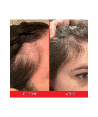 HAIRtamin Advanced Formula 30 Vegan Capsules - Hair Vitamin - Buy Online on GoSupps.com