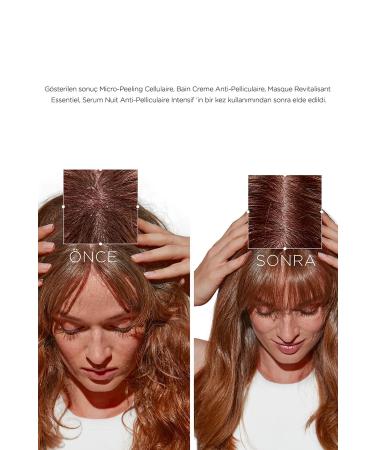 Kerastase ..-*Kerastase Symbiose Micro-Peeling Cellulaire 200 ML -Sensitive Scalp Purifier-CYT4454..- - Buy Online on GoSupps.com