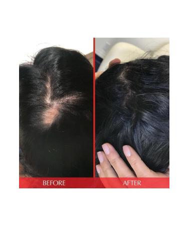 HAIRtamin Advanced Formula 30 Vegan Capsules - Hair Vitamin - Buy Online on GoSupps.com