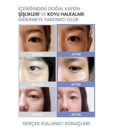 OOTD Anti-Puffiness and Dark Circle Intensive Eye Cream with Caffeine - Buy Online on GoSupps.com