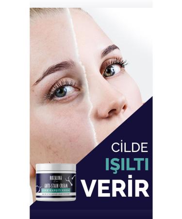 Rozalina Rise Anti-Blemish Armpit-Knee-Elbow and Bikini Area Skin Whitening Cream 100 ml - Buy Online on GoSupps.com