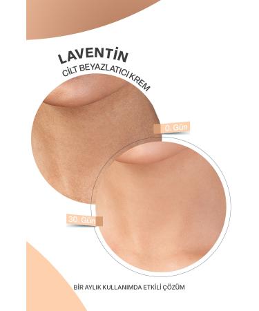 Laventin Underarm-Knee-Elbow and Bikini Area Skin Whitening Cream 100 Ml - Buy Online on GoSupps.com