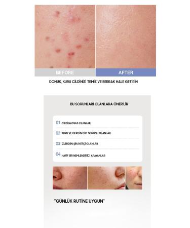 OOTD Anti-Wrinkle Intensive Moisture Face Serum (CREAM) - Buy Online on GoSupps.com