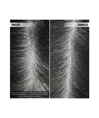 Oriflame DUOLOGI Anti-Dandruff Purifying Shampoo - Buy Online on GoSupps.com