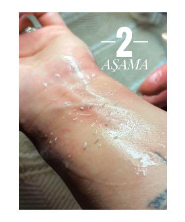 Clemency Peeling Gel 125ml Lightening Skin Purifying Whitening Pore Minimizer - Buy Online on GoSupps.com