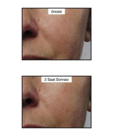 Murad Rapid Collagen Infusion Instant Firming Collagen Serum 30 ml - Buy Online on GoSupps.com