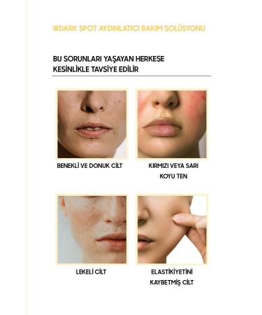 OOTD Dark Spot Vita C Serum for Brightening Dark Skin Spots - Buy Online on GoSupps.com