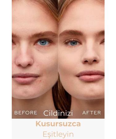 Caria Intensive Coverage Foundation - Buy Online on GoSupps.com