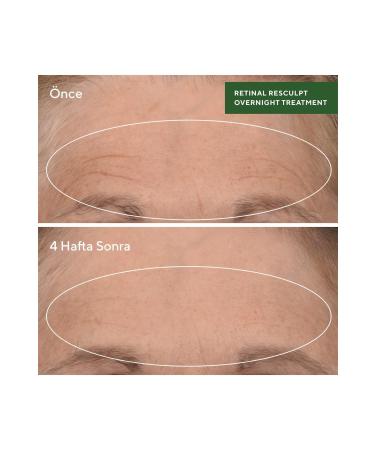 Murad Retinal Resculpt Overnight Treatment - Retinal Regenerating Miracle Night Serum - Buy Online on GoSupps.com