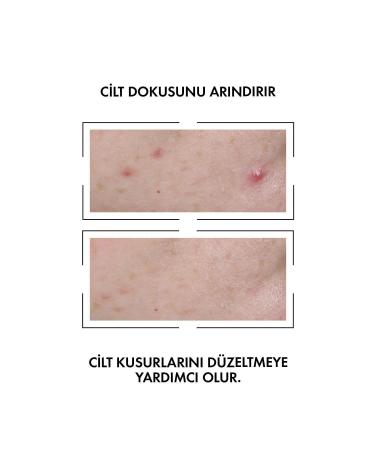 Vichy Normaderm Probio Bha Peeling Effective Anti-Skin Imperfection Serum 30 ml - Buy Online on GoSupps.com