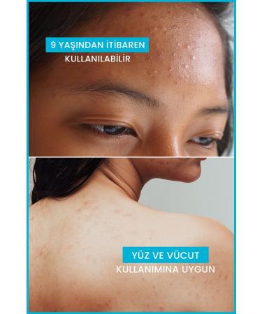 Ducray Keracnyl Gel Cleansing Gel for Oily and Acne Prone Skin 400ml - Buy Online on GoSupps.com