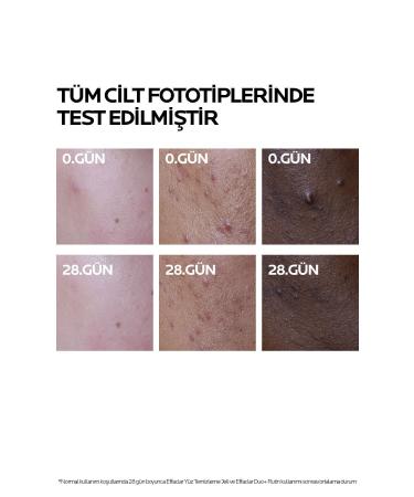 La Roche Posay Effaclar Duo+M Face Care Cream for Oily and Acne Prone Skin 40 ml Passi.2106 - Buy Online on GoSupps.com