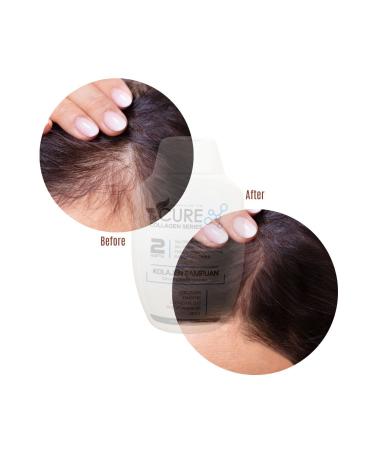 Dr. Cure Dr.cure Collagen Shampoo 300 ml & Serum 100 ml - Buy Online on GoSupps.com