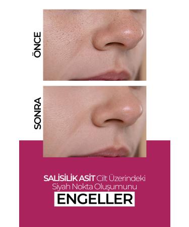 New Well Moisturizing Skin Renewal Anti-Spot Cream 50ML - Buy Online on GoSupps.com