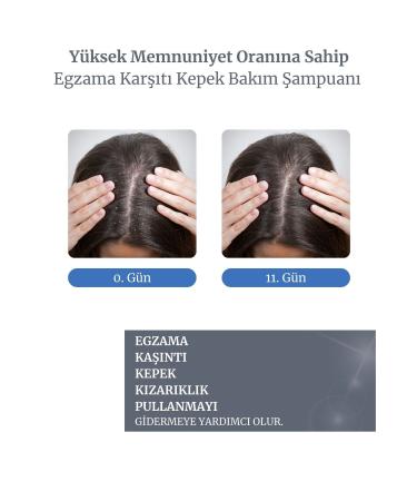 izderma Relief Anti-Dandruff Itching Flaking Care Shampoo - Buy Online on GoSupps.com