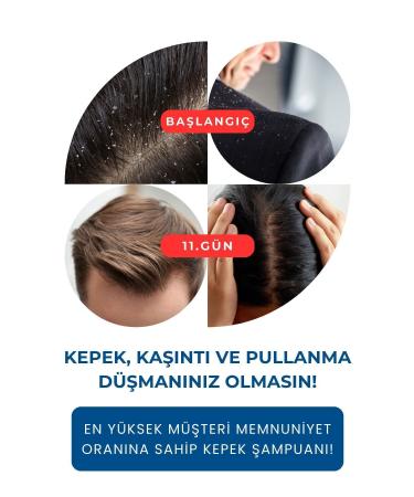 izderma Relief Shampoo Set of 2 - Itching Redness Flaking Anti-Dandruff - Buy Online on GoSupps.com