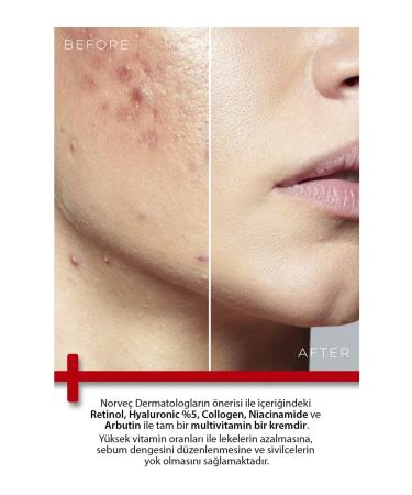 TODAYS CLINICALS Todays Clinicals Repair Cream 100ml + De femme Hair Protein Gift - Buy Online on GoSupps.com