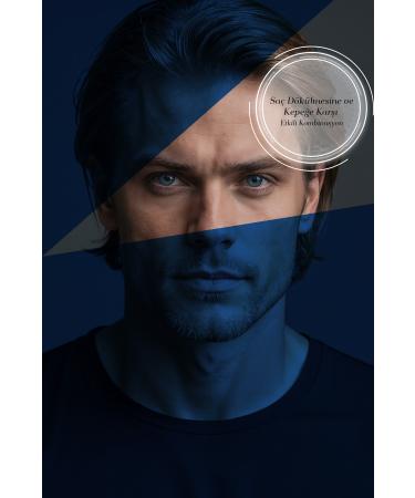 Bioxcin Anti-Dandruff Hair Loss Shampoo 500Ml - L-Carnitine Caffeine Biocomplexb11 Men Sport - Buy Online on GoSupps.com