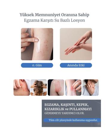 izderma Relief Water Based Lotion - Buy Online on GoSupps.com