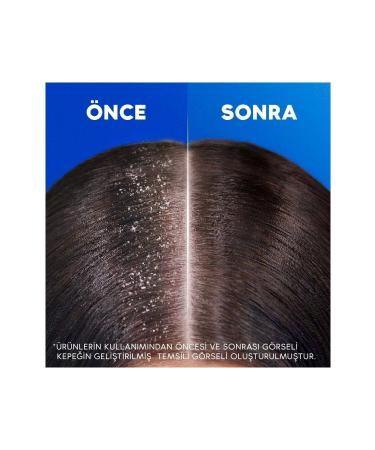 Head And Shoulders Shampoo For Men Effective Against Hair Loss 2in1 330 ml - Buy Online on GoSupps.com