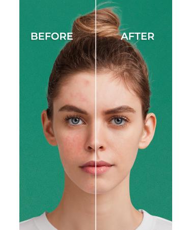 Sinoz Pure Cica Instant Tone Equalizing and Repairing Face Care Cream - New Generation Mineral Sun Filter Spf50 - Buy Online on GoSupps.com