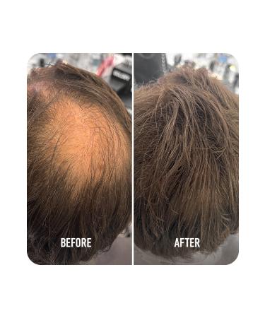 Boldify Hair Building Fibers Topical Powder Light Brown 12 gr- Hair Building Fibers - Buy Online on GoSupps.com