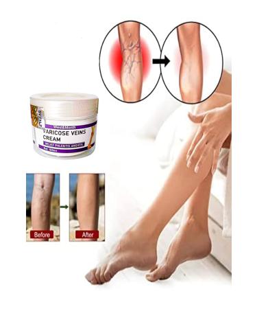 H NTOHU Varicose and Spider Veins Soothing Leg Cream Leg Care Cream 100 ml