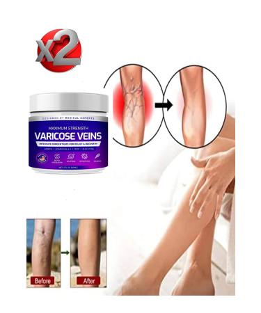 H NTOHU Varicose Veins Purple Cream Silliti and its opposite 100 ml x 2 pcs