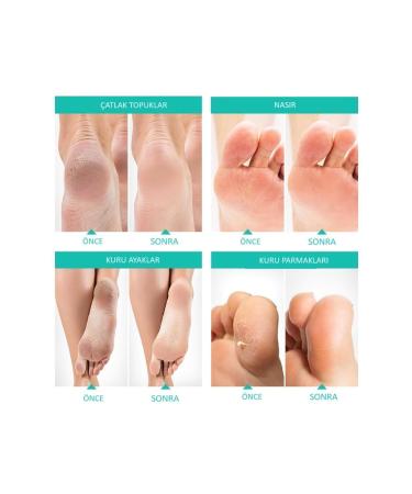 Dr Family Foot Peeling Mask - Peelable Exfoliating Foot Care Removes Odor and Calluses - Buy Online on GoSupps.com