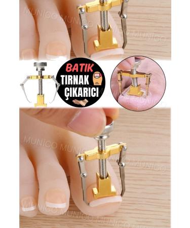 The End of Ingrown Nails at Home - Adjustable and Unbreakable Steel Tool