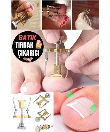 Ingrown Nail Removal Professional Tool You Can Use At Home Easy To Use Ingrown Nail Removal