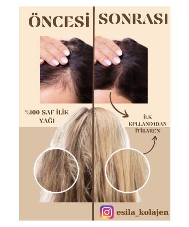 ES LA COLLAGEN 0 Pure Marrow Oil Care - Miraculous Effect on Hair Loss - 2 Pieces 40 Ml Size - Monthly Cure - Buy Online on GoSupps.com