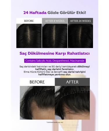 Lador Anti-Loss Purifying and Intensive Moisturizing Hair Care Shampoo LADOR Root Re-Boot Ginger Apple - Buy Online on GoSupps.com