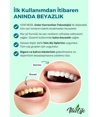  lla Life Whitening Expert Fast Acting Teeth Whitening Gel New Generation Teeth Polishing and Cleaning Gel 50 ml - Buy Online on GoSupps.com