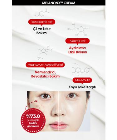 Medipeel Stain and Freckle Cream Medipeel Melanon X Cream 30ml - Buy Online on GoSupps.com