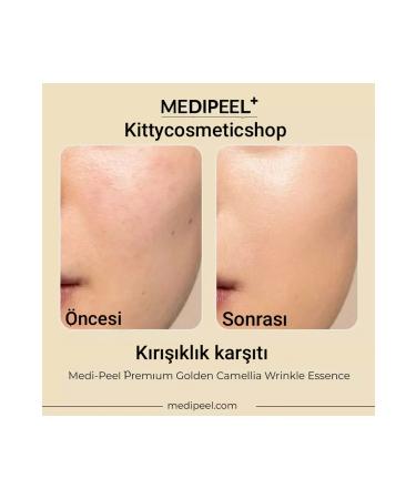 Medipeel Premium Golden Camellia Wrinkle Essence 50 ml(Golden Camellia Wrinkle Essence) - Buy Online on GoSupps.com