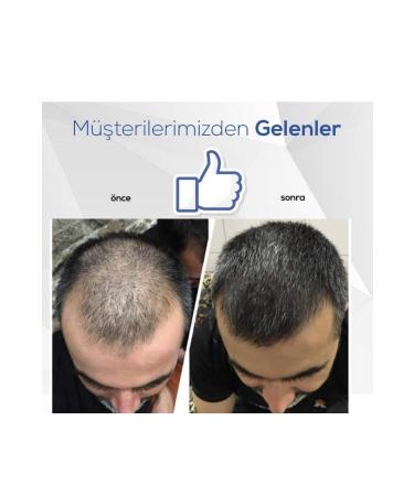 Blue Serum Blue Hair Care Serum Hair Growth Blue Water - Buy Online on GoSupps.com