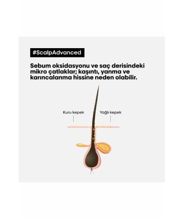 L'oreal Professionnel Serie Expert Scalp Advanced Anti-Dandruff Professional Shampoo 500 ml - Buy Online on GoSupps.com