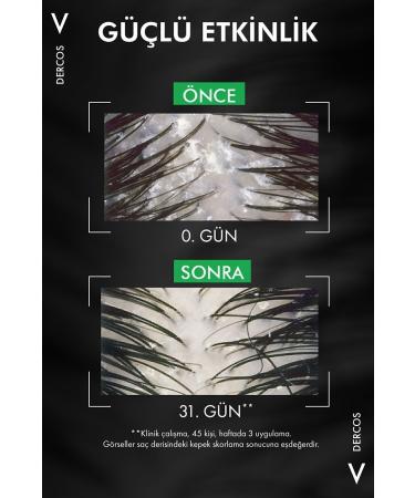 Vichy Dercos Anti Dandruff Anti Dandruff Shampoo 390 ml - Normal and Oily Hair - Buy Online on GoSupps.com