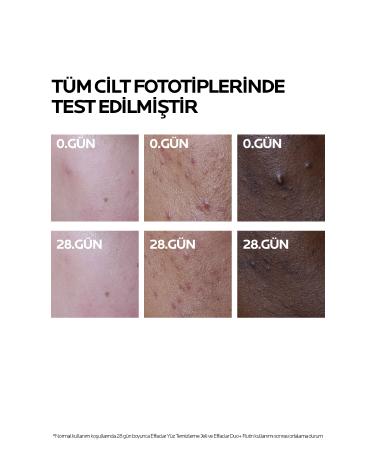 La Roche Posay Effaclar Duo+M Skin Care Cream 40ml- Oily and Acne Prone Skin - Buy Online on GoSupps.com