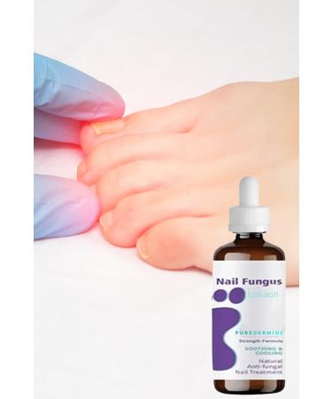 Puredermine Herbal Lotion & Effective Solution & Fungus & Broken Nails & Hand & Foot Care - Buy Online on GoSupps.com