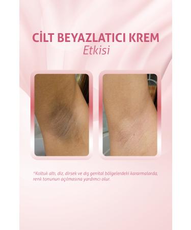 Arab Makeup World Skin Whitening & Ginseng Peeling 2-Piece Set - Buy Online on GoSupps.com