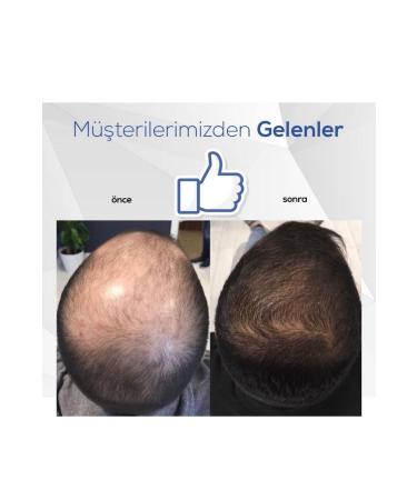 Blue Serum Blue Hair Care Serum Hair Growth Blue Water - Buy Online on GoSupps.com