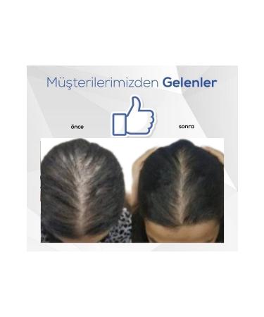 Blue Serum Blue Hair Care Serum Hair Growth Blue Water - Buy Online on GoSupps.com